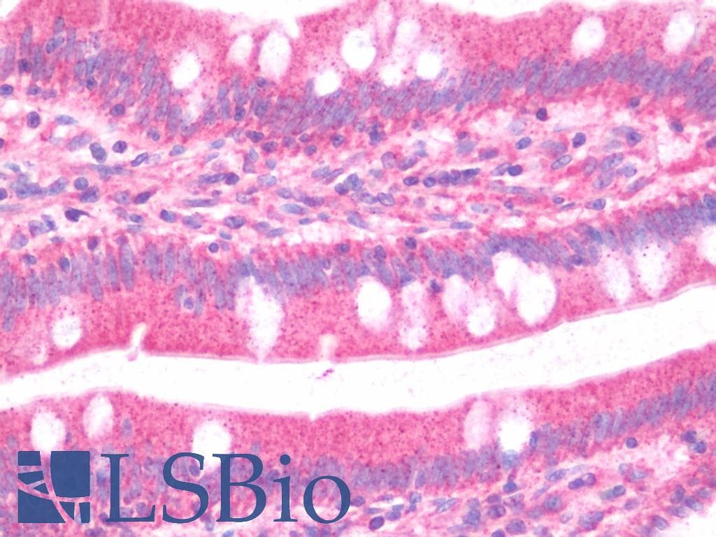 IHC-plus™ Polyclonal Rabbit anti-Human GBP5 Antibody (IHC, WB)