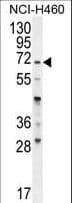 FUT4 / CD15 Antibody (aa495-524)