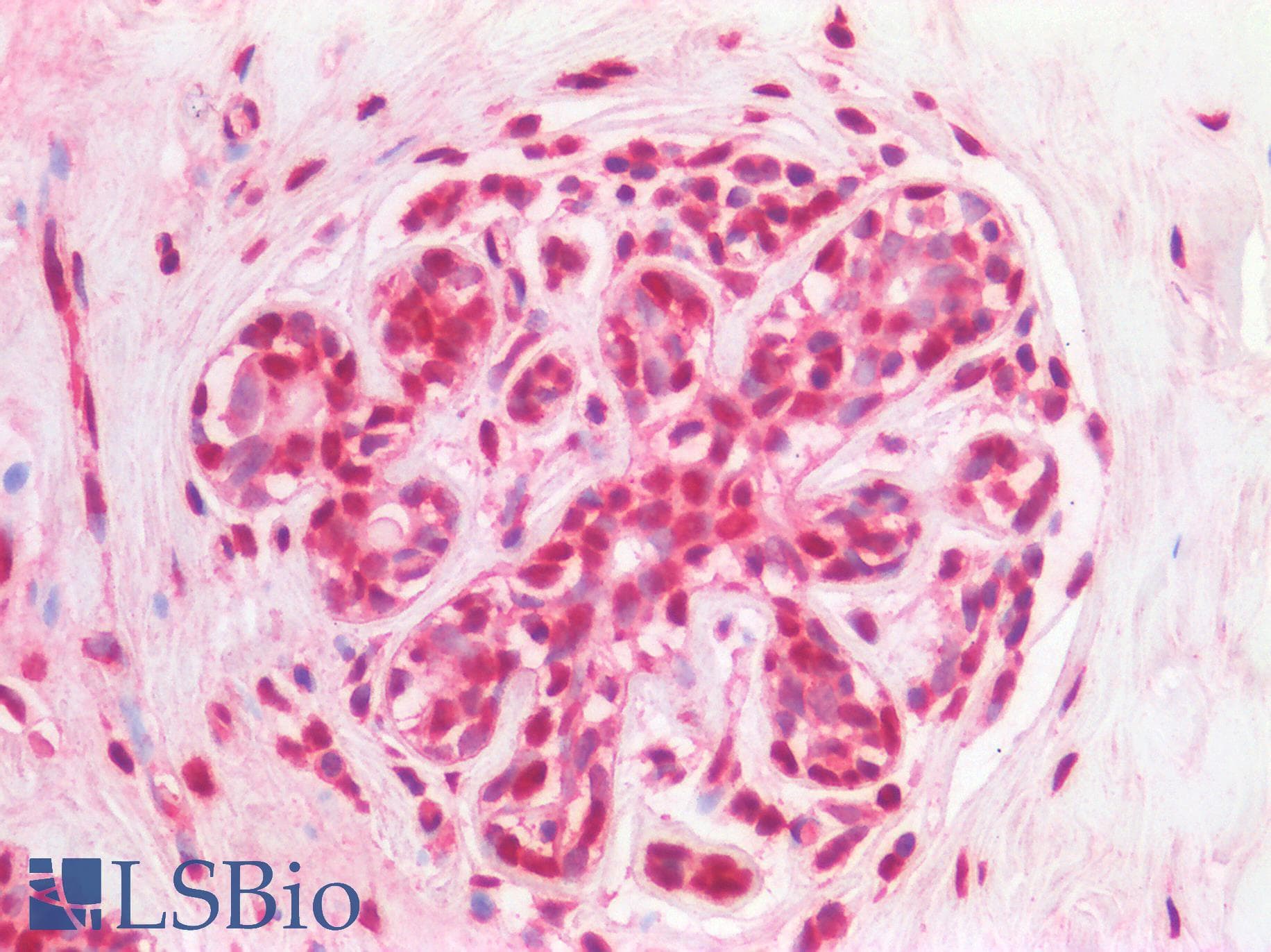 PathPlus™ Polyclonal Rabbit anti-Human SMC1A / SMC1 Antibody (IHC, IF, WB)