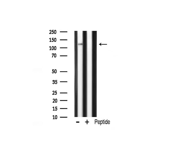 CARD6 Antibody
