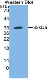 LCP2 / SLP-76 Antibody (aa202-463)