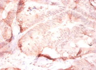 COL4A2 / Collagen IV Alpha2 Antibody