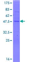 Human SSH2 Protein (Recombinant GST)