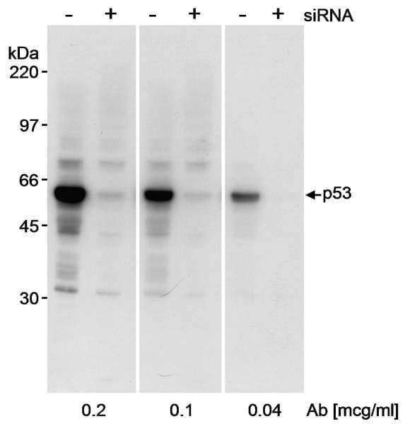 Polyclonal Rabbit anti-Human TP53 / p53 Antibody (aa50-100, IHC, WB)