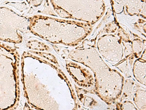 Polyclonal Rabbit anti-Human IPO11 / Importin 11 Antibody (IHC, WB)