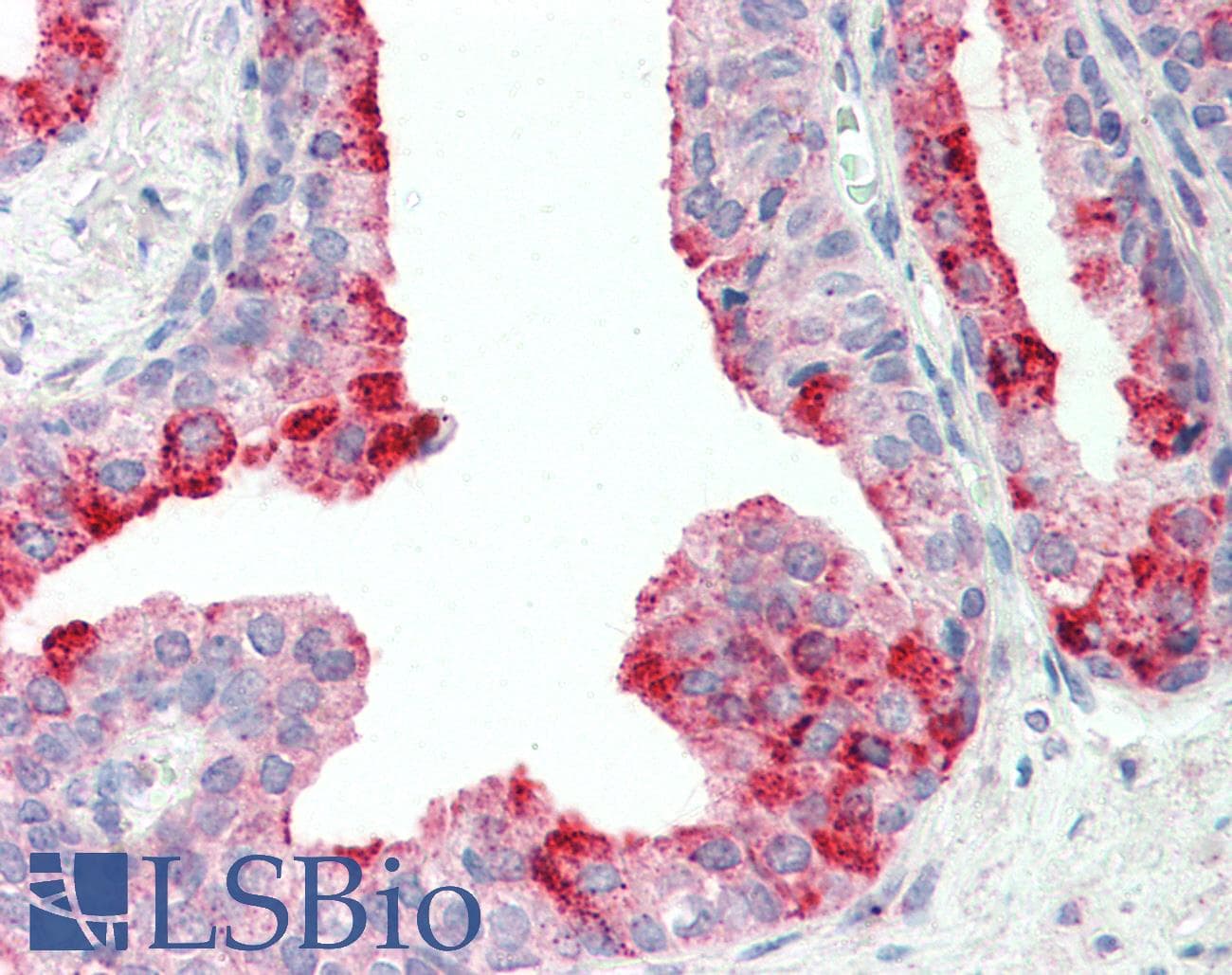 IHC-plus™ Polyclonal Goat anti-Human CUTA Antibody (aa185-195, IHC, WB)