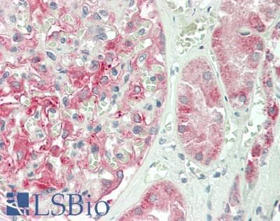 IHC-plus™ PH / PAH Antibody (C-Terminus)