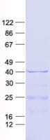Human MRPL4 / MRP-L4 Protein (Recombinant His, N-Terminal)