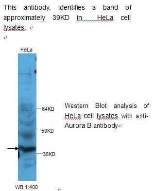AURKB / Aurora-B Antibody
