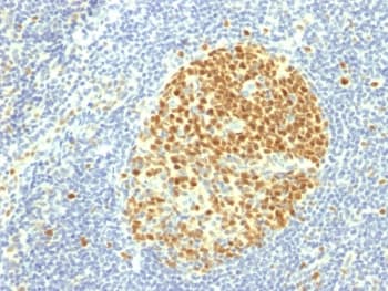 MCM7 Antibody (clone MCM7/1469)
