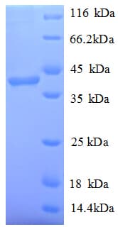 Human PARP11 Protein (Recombinant His)
