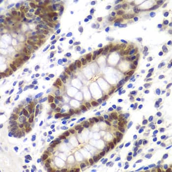 Polyclonal Rabbit anti-Human MSH6 Antibody (IHC, IF, WB)