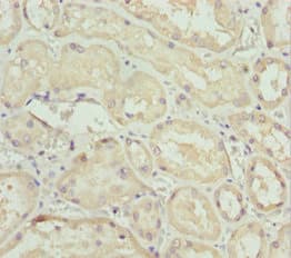 Polyclonal Rabbit anti-Human PEA15 / PEA-15 Antibody (IHC, IF, WB)