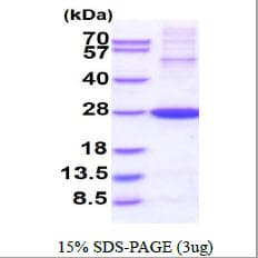 Human TSN / Translin Protein (Recombinant)