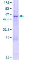 Human NIPSNAP1 Protein (Recombinant GST)
