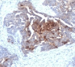 TAG-72 Antibody (clone CA72/733, Ready-to-Use)
