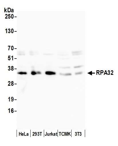 IHC-plus™ Polyclonal Rabbit anti-Human RPA2 / RFA2 / RPA34 Antibody (aa225-C-term, IHC, WB)