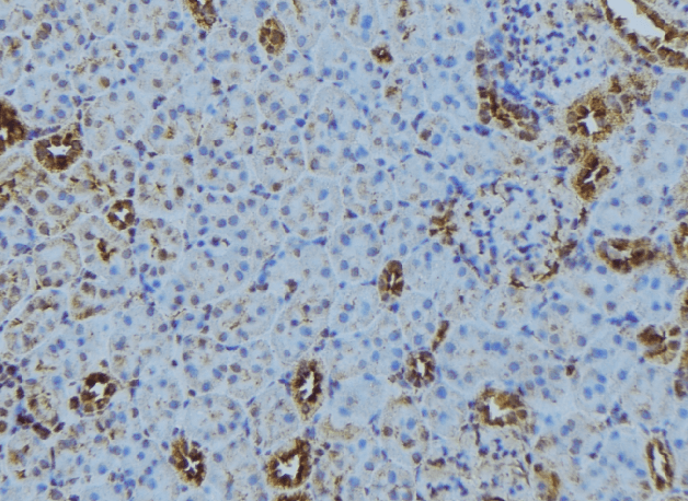 Polyclonal Rabbit anti-Human TRAPPC5 Antibody (IHC, WB)