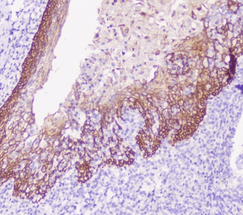 CDH3 / P-Cadherin Antibody