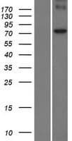 POMT1 Protein (Over-Expression Lysate Myc-DDK (Flag))