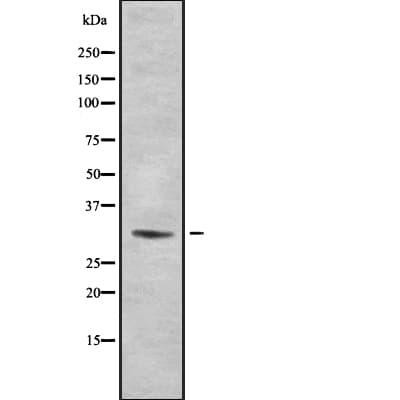 RPS2 / Ribosomal Protein S2 Antibody