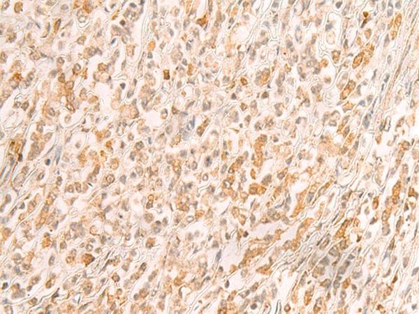 Polyclonal Rabbit anti-Human SREBF2 / SREBP2 Antibody (IHC)