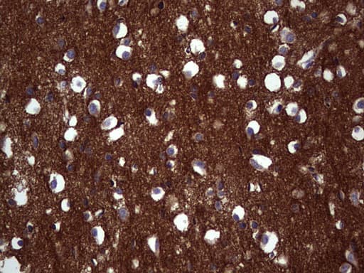 NCAM / CD56 Antibody (aa20-718, clone OTI1A3, Carrier-free)