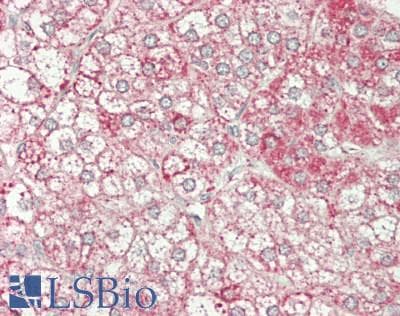 IHC-plus™ DENN / MADD Antibody (aa1597-1647)