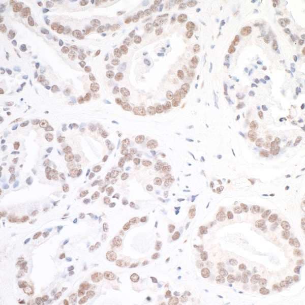 H2AFX / H2AX Antibody (phospho-Ser140)