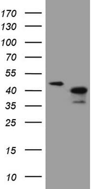 Monoclonal Mouse anti-Human ANKRA2 / ANKRA Antibody (clone OTI8A9, Carrier-free, WB)