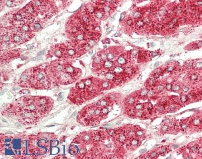 IHC-plus™ Polyclonal Rabbit anti-Human CTSA / Cathepsin A Antibody (aa18-45, IHC, WB)