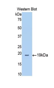 THBS1 / Thrombospondin-1 Antibody (aa327-478)
