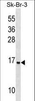 UTS2B / U2B Antibody (aa15-44)