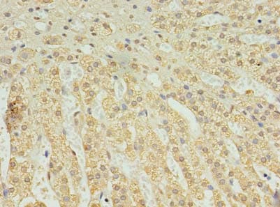 Polyclonal Rabbit anti-Human C2orf15 Antibody (IHC, WB)