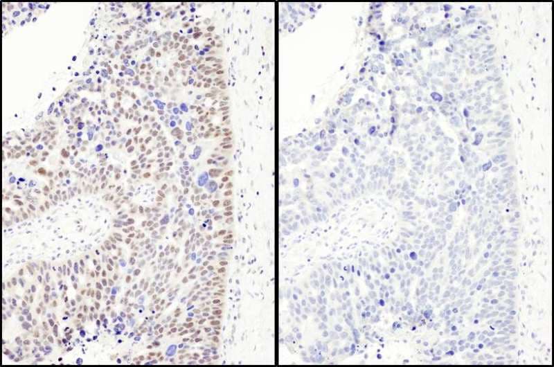 RELA / NFKB p65 Antibody (phospho-Ser468)