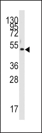 Polyclonal Rabbit anti-Human PDK4 Antibody (aa83-111, IHC, IF, WB)