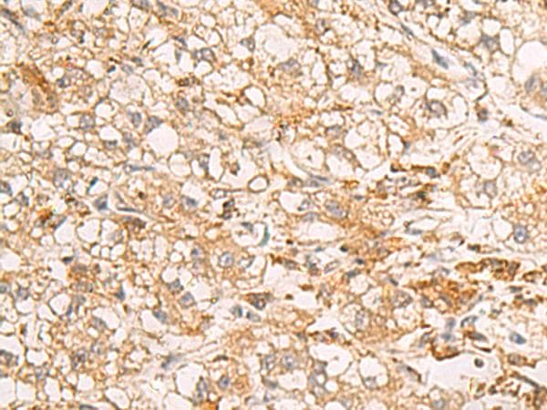 Polyclonal Rabbit anti-Human RAB38 Antibody (IHC)
