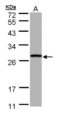 IHC-plus™ GSTT1 Antibody (aa1-240)