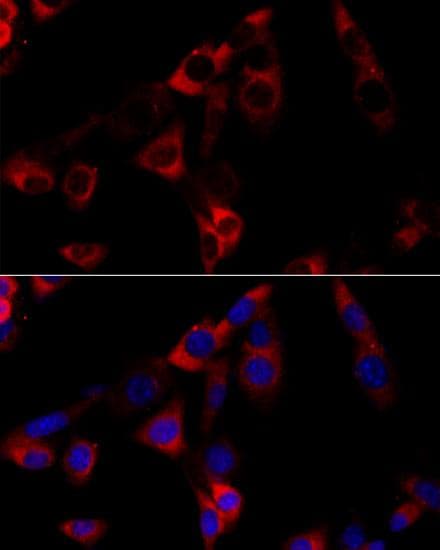 HSP90B1 / GP96 / GRP94 Antibody