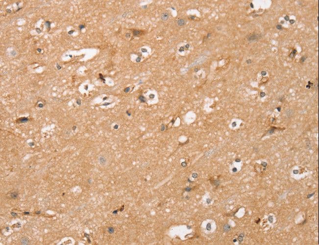 GAPIII / RASA3 Antibody