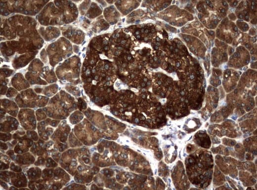 NME1 / NM23 Antibody (clone UMAB91)