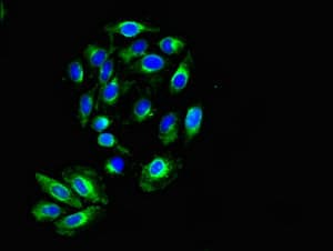 KIR2DS2 / CD158j Antibody