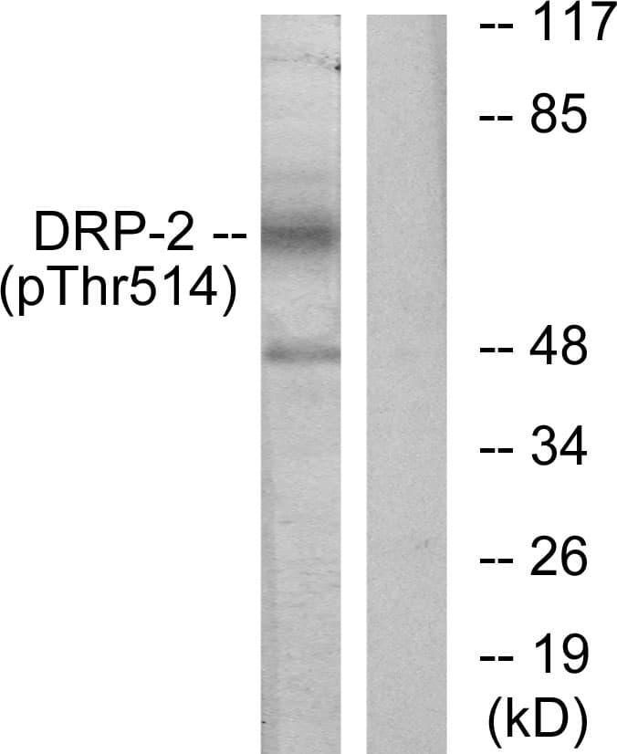DPYSL2 / CRMP2 Antibody (phospho-Thr514)