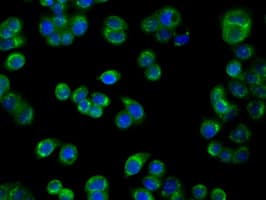 PIM2 / Pim-2 Antibody (clone OTI5D5)