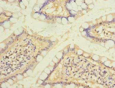 Polyclonal Rabbit anti-Human RAB6B Antibody (IHC, WB)