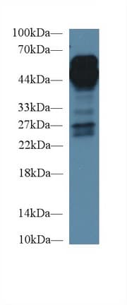 AGER / RAGE Antibody (aa91-366, Biotin)