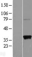 SLAMF9 Protein (Over-Expression Lysate Myc-DDK (Flag))