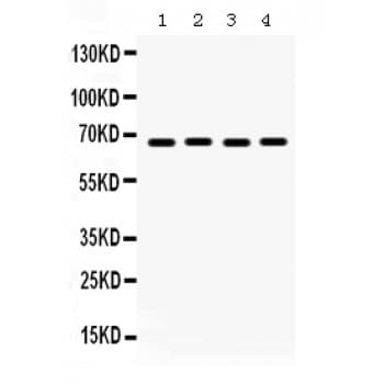 PEA3 / ETV4 Antibody (aa1-41)
