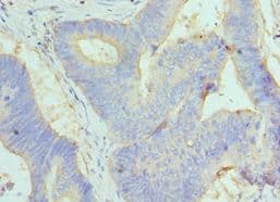 GC / Vitamin D-Binding Protein Antibody (aa305-474)