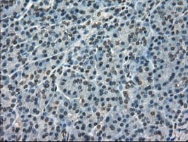 KIND2 / FERMT2 Antibody (clone OTI14A11)